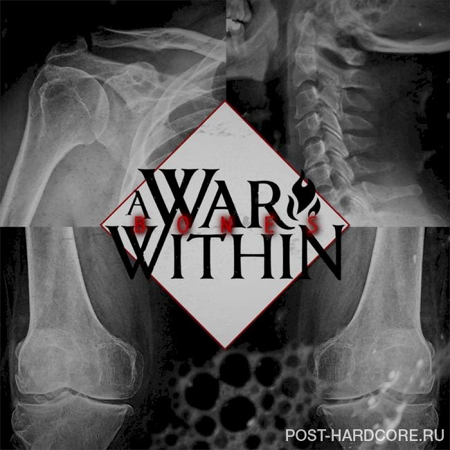A War Within - Bones [single] (2021)